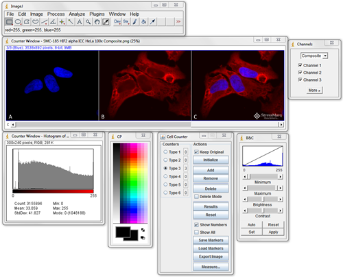 aida image analysis software download
