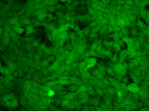 High Background ICC staining - Immunocytochemistry Troubleshooting