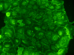 Non-specific ICC staining - Immunocytochemistry Troubleshooting