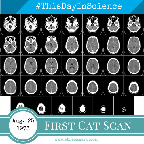 First CAT Scan Aug. 28, 1975 - This Day in Science
