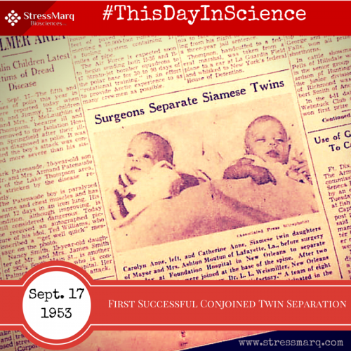 This Day in Science Sept. 17 1963 - First Conjoined twins separated