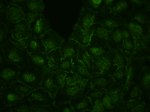 Weak or no signal ICC staining - Immunocytochemistry Troubleshooting