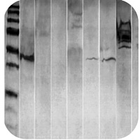 Western blot troubleshooting - Smile Bands