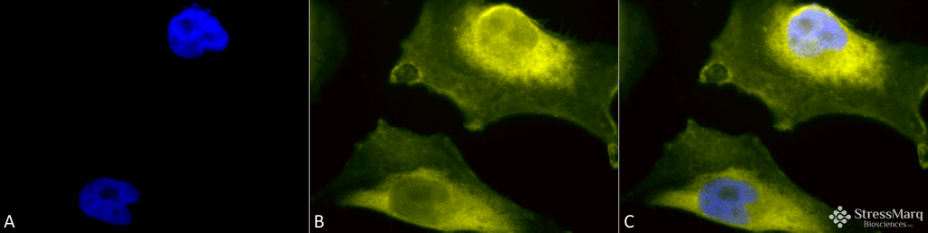 <p>Immunocytochemistry/Immunofluorescence analysis using Rabbit Anti-SOD1 (UBB) Polyclonal Antibody (SPC-205). Tissue: Cervical cancer cell line (HeLa). Species: Human. Fixation: 2% Formaldehyde for 20 min at RT. Primary Antibody: Rabbit Anti-SOD1 (UBB) Polyclonal Antibody (SPC-205) at 1:110 for 12 hours at 4°C. Secondary Antibody: R-PE Goat Anti-Rabbit (yellow) at 1:200 for 2 hours at RT. Counterstain: DAPI (blue) nuclear stain at 1:40000 for 2 hours at RT. Localization: Cytoplasm. Nucleus. Mitochondrion. Magnification: 100x. (A) DAPI (blue) nuclear stain. (B) Anti-SOD1 (UBB) Antibody. (C) Composite.</p>
