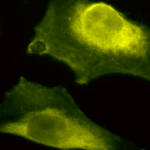 SPC-205_SOD1-UBB_Antibody_ICC-IF_Human_HeLa-Cells_100x_Composite.png