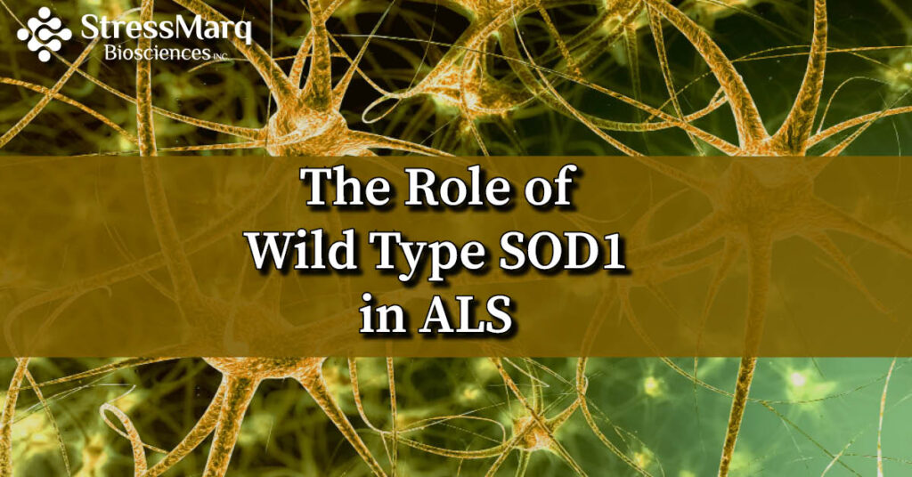 Wild Type SOD1 in ALS