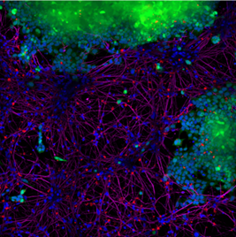 Image of StressMarq Alpha Synuclein PFFs