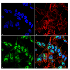 Immunocytochemistry analysis