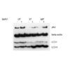 Western Blot of the Example Results for the Autophagy Flux Detection Kit StressXpress - SKT-135