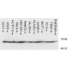 Mouse Anti-Hsp70 Antibody [C92F3A-5] used in Western Blot (WB) on Human cell lysates from various cell lines (SMC-100)