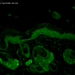 SMC-104_Hsp70_Antibody_N27_IHC_Mouse_backskin_1.png