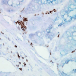 SMC-106_Hsp70_Antibody_BB70_IHC_Mouse_inflamed-colon_40x_1.png