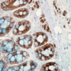 Mouse Anti-Hsp90 Antibody [H9010] used in Immunohistochemistry (IHC) on Human colon carcinoma (SMC-107)
