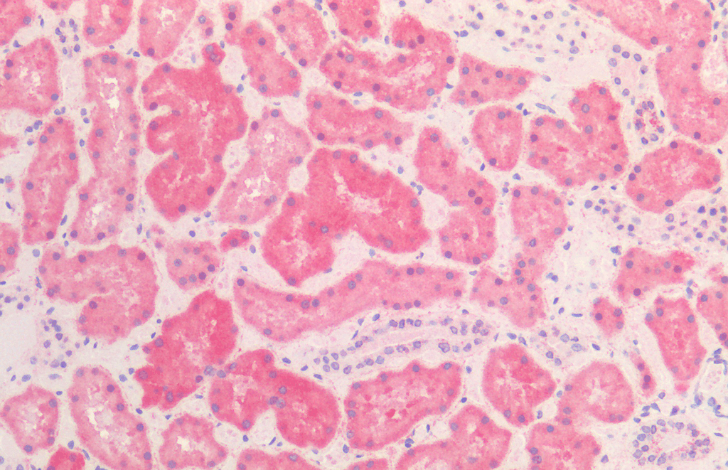 <p>Immunohistochemistry analysis using Mouse Anti-HSP60 Monoclonal Antibody, Clone LK2 (SMC-111). Tissue: Kidney. Species: Human. Fixation: Formalin Fixed, Paraffin Embedded. Primary Antibody: Mouse Anti-HSP60 Monoclonal Antibody (SMC-111).</p>
