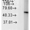 Mouse Anti-Hsp60 Antibody [LK-2] used in Western Blot (WB) on Human Heat Shocked cervical cancer cell line (HeLa) lysate (SMC-111)