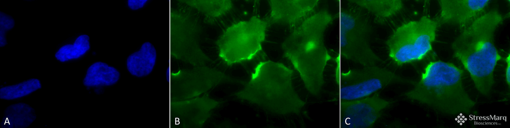 <p>Immunocytochemistry/Immunofluorescence analysis using Mouse Anti-CD74 Monoclonal Antibody, Clone PIN 1.1 (SMC-116). Tissue: Cervical cancer cell line (HeLa). Species: Human. Fixation: 2% Formaldehyde for 20 min at RT. Primary Antibody: Mouse Anti-CD74 Monoclonal Antibody (SMC-116) at 1:100 for 12 hours at 4°C. Secondary Antibody: FITC Goat Anti-Mouse (green) at 1:200 for 2 hours at RT. Counterstain: DAPI (blue) nuclear stain at 1:40000 for 2 hours at RT. Localization: Cell membrane. Endoplasmic reticulum membrane. Golgi apparatus. Endosome. Lysosome. Magnification: 100x. (A) DAPI (blue) nuclear stain. (B) Anti-CD74 Antibody. (C) Composite.</p>
