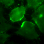 SMC-116_CD74_Antibody_PIN-1-1_ICC-IF_Human_HeLa-Cells_100x_Composite.png