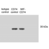Mouse Anti-CD74 Antibody [PIN 1.1] used in Western Blot (WB) on Human N87 cell lysates (SMC-116)