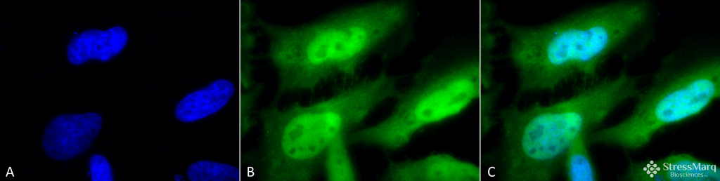 <p>Immunocytochemistry/Immunofluorescence analysis using Rat Anti-HSF1 Monoclonal Antibody, Clone 10H8 (SMC-118). Tissue: Heat Shocked cervical cancer cells (HeLa). Species: Human. Fixation: 2% Formaldehyde for 20 min at RT. Primary Antibody: Rat Anti-HSF1 Monoclonal Antibody (SMC-118) at 1:100 for 12 hours at 4°C. Secondary Antibody: FITC Goat Anti-Rat (green) at 1:200 for 2 hours at RT. Counterstain: DAPI (blue) nuclear stain at 1:40000 for 2 hours at RT. Localization: Diffuse nuclear and cytoplasmic staining. Magnification: 100x. (A) DAPI (blue) nuclear stain. (B) Anti-HSF1 Antibody. (C) Composite. Heat Shocked at 42°C for 1h.</p>
