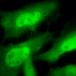 SMC-118_HSF1_Antibody_10H8_ICC-IF_Human_Heat-Shocked-HeLa-Cells_100x_Composite.png