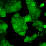 SMC-122_PSD95_Antibody_6G6_ICC-IF_Human_HaCaT-cells_1.png