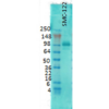 Mouse Anti-PSD95 Antibody [6G6] used in Western Blot (WB) on Rat brain membrane lysate (SMC-122)