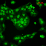 SMC-124_CaMKII_Antibody_6G9_ICC-IF_Human_HaCaT-cells_1.png