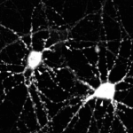 SMC-125_CaMKII_Antibody_22B1_ICC-IF_Rat_dissociated-hippocampal-neurons_10X_1.png