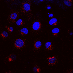 SMC-129_KDEL-Receptor_Antibody_KR-10_ICC-IF_Rat_NRK-cells_1.png