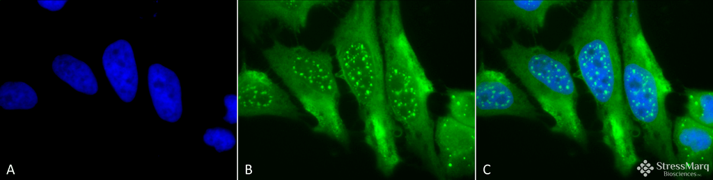 <p>Immunocytochemistry/Immunofluorescence analysis using Mouse Anti-HO-1 Monoclonal Antibody, Clone 1F12-A6 (SMC-131). Tissue: Cervical cancer cell line (HeLa). Species: Human. Fixation: 2% Formaldehyde for 20 min at RT. Primary Antibody: Mouse Anti-HO-1 Monoclonal Antibody (SMC-131) at 1:100 for 12 hours at 4°C. Secondary Antibody: FITC Goat Anti-Mouse (green) at 1:200 for 2 hours at RT. Counterstain: DAPI (blue) nuclear stain at 1:40000 for 2 hours at RT. Localization: Microsome. Endoplasmic reticulum. Localizes to the nucleus upon hypoxia. Magnification: 100x. (A) DAPI (blue) nuclear stain. (B) Anti-HO-1 Antibody. (C) Composite.</p>
