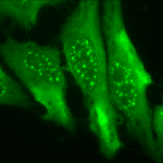 SMC-131_HO-1_Antibody_1F12-A6_ICC-IF_Human_HeLa-Cells_100x_Composite.png