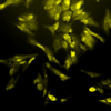 Mouse Anti-HO-1 Antibody [1F12-A6] used in Immunocytochemistry/Immunofluorescence (ICC/IF) on Human Cervical cancer cell line (HeLa) (SMC-131)