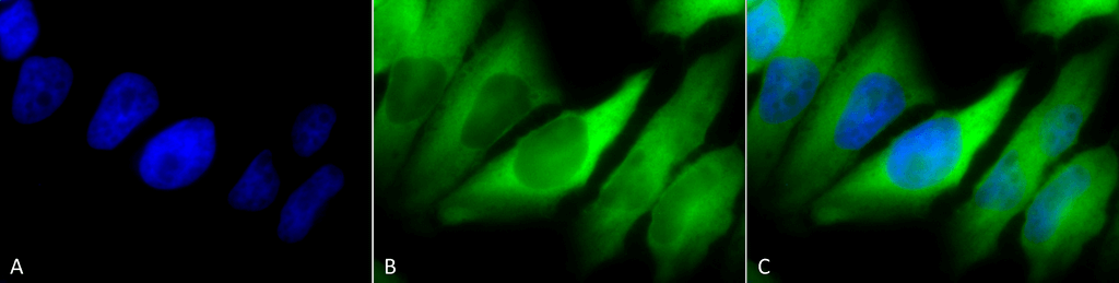 <p>Immunocytochemistry/Immunofluorescence analysis using Mouse Anti-Hsp90 alpha/beta Monoclonal Antibody, Clone K41220A (SMC-135). Tissue: Cervical cancer cell line (HeLa). Species: Human. Fixation: 2% Formaldehyde for 20 min at RT. Primary Antibody: Mouse Anti-Hsp90 alpha/beta Monoclonal Antibody (SMC-135) at 1:100 for 12 hours at 4°C. Secondary Antibody: FITC Goat Anti-Mouse (green) at 1:200 for 2 hours at RT. Counterstain: DAPI (blue) nuclear stain at 1:40000 for 2 hours at RT. Localization: Cytoplasm. Melanosome. Magnification: 100x. (A) DAPI (blue) nuclear stain. (B) Anti-Hsp90 alpha/beta Antibody. (C) Composite.</p>
