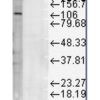 Mouse Anti-LAMP1 Antibody [Ly1C6] used in Western Blot (WB) on Rat liver microsome lysate (SMC-140)