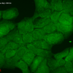 SMC-145_Hsp40_Antibody_3B9-E6_ICC-IF_Human_HaCaT-cells_2.png