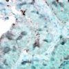 Mouse Anti-Hsp90 Antibody [4F3.E8] used in Immunohistochemistry (IHC) on Human colon carcinoma (SMC-149)