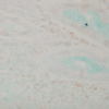 Mouse Anti-p38 MAPK Antibody [9F12] used in Immunohistochemistry (IHC) on Human colon carcinoma (SMC-152)