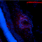 SMC-152_p38-MAPK_Antibody_9F12_IHC_Mouse_Retinal-Injury-Model_1.png