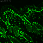 SMC-153_Acetylated-Lysine_Antibody_7F8_IHC_Mouse_backskin_1.png