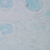 Mouse Anti-Nitrotyrosine Antibody [39B6] used in Immunohistochemistry (IHC) on Human colon carcinoma (SMC-154)