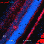 SMC-154_Nitrotyrosine_Antibody_39B6_IHC_Mouse_Retinal-Injury-Model_1.png