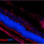 SMC-155_DNA-Damage_Antibody_15A3_IHC_Mouse_Retinal-Injury-Model_1.png