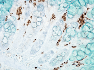 IHC staining of mouse inflamed colon using DNA Damage Antibody cat#SMC-155