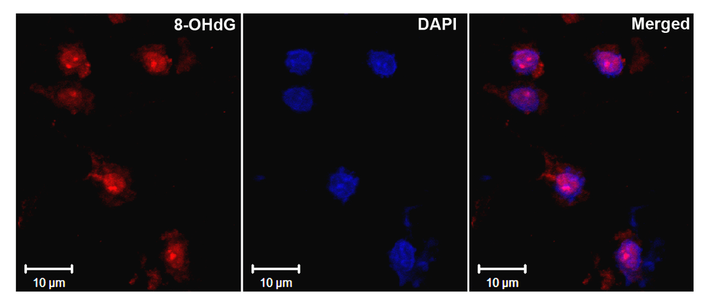 <p>Immunohistochemistry analysis using Mouse Anti-DNA Damage Monoclonal Antibody, Clone 15A3 (SMC-155). Tissue: Ischemic fresh brain tissue. Species: Rat. Primary Antibody: Mouse Anti-DNA Damage Monoclonal Antibody (SMC-155) at 1:1000 for 16 hours at RT. Secondary Antibody: Alexa Fluor 546 Goat Anti-mouse (Red) at 1:500 for 1 hour at RT. Localization: Cerebral Cortex. Courtesy of: Dr. Yi Yang, U. New Mexico.</p>
