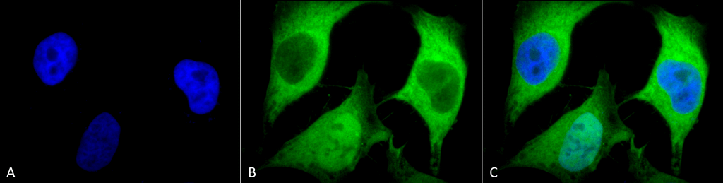 <p>Immunocytochemistry/Immunofluorescence analysis using Mouse Anti-Ubiquitin Monoclonal Antibody, Clone 5B9-B3 (SMC-160). Tissue: Cervical cancer cell line (HeLa). Species: Human. Fixation: 2% Formaldehyde for 20 min at RT. Primary Antibody: Mouse Anti-Ubiquitin Monoclonal Antibody (SMC-160) at 1:100 for 12 hours at 4°C. Secondary Antibody: FITC Goat Anti-Mouse (green) at 1:200 for 2 hours at RT. Counterstain: DAPI (blue) nuclear stain at 1:40000 for 2 hours at RT. Localization: Diffuse nuclear and cytoplasmic staining. Magnification: 100x. (A) DAPI (blue) nuclear stain. (B) Anti-Ubiquitin Antibody. (C) Composite.</p>
