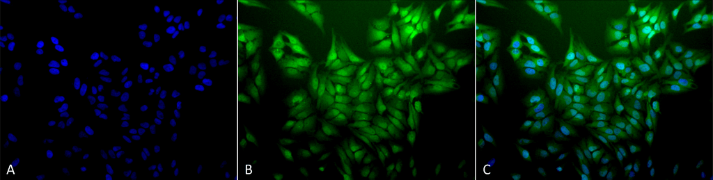 <p>Immunocytochemistry/Immunofluorescence analysis using Mouse Anti-Ubiquitin Monoclonal Antibody, Clone 5B9-B3 (SMC-160). Tissue: Cervical cancer cell line (HeLa). Species: Human. Fixation: 2% Formaldehyde for 20 min at RT. Primary Antibody: Mouse Anti-Ubiquitin Monoclonal Antibody (SMC-160) at 1:100 for 12 hours at 4°C. Secondary Antibody: FITC Goat Anti-Mouse (green) at 1:200 for 2 hours at RT. Counterstain: DAPI (blue) nuclear stain at 1:40000 for 2 hours at RT. Localization: Diffuse nuclear and cytoplasmic staining. Magnification: 20x. (A) DAPI (blue) nuclear stain. (B) Anti-Ubiquitin Antibody. (C) Composite.</p>
