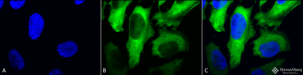 <p>Immunocytochemistry/Immunofluorescence analysis using Mouse Anti-Hsp27 Monoclonal Antibody, Clone 5D12-A3 (SMC-161). Tissue: Heat Shocked cervical cancer cells (HeLa). Species: Human. Fixation: 2% Formaldehyde for 20 min at RT. Primary Antibody: Mouse Anti-Hsp27 Monoclonal Antibody (SMC-161) at 1:100 for 12 hours at 4°C. Secondary Antibody: FITC Goat Anti-Mouse (green) at 1:200 for 2 hours at RT. Counterstain: DAPI (blue) nuclear stain at 1:40000 for 2 hours at RT. Localization: Cytoplasm. Nucleus. Magnification: 100x. (A) DAPI (blue) nuclear stain. (B) Anti-Hsp27 Antibody. (C) Composite. Heat Shocked at 42°C for 1h.</p>
