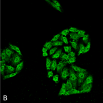 SMC-162-HSP70-Antibody-5A5-ICC-IF-Human-Cervical-Cancer-cell-line-HeLa-40X-Composite-1.png