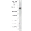 Mouse Anti-Hsp70 Antibody [5A5] used in Western Blot (WB) on Rat skeletal muscle tissue lysate (SMC-162)