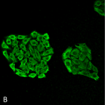 SMC-164-HSP70-Antibody-3A3-ICC-IF-Human-Cervical-Cancer-cell-line-HeLa-40X-Composite-1.png